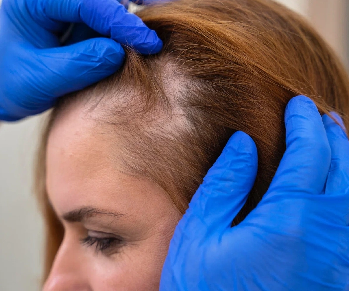 Advanced PRP Hair Grow Treatment Clinic in Chennai Photo of a hair restoration clinic in Chennai offering advanced growth treatments in a clean space